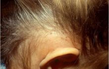 دلایل ایجاد شپش در موی سر کودکان و روش های درمان